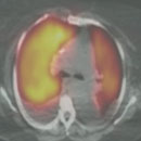 Nuclear Medicine